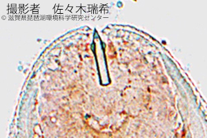 ネズミシャコウキュウチュウ（ネズミ斜睾吸虫）