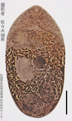 Metagonimus yokogawai