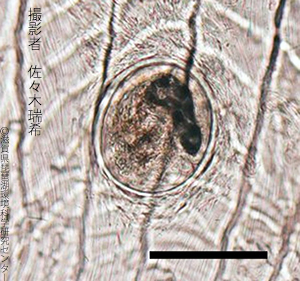 ヨコガワキュウチュウ（横川吸虫）